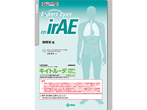Expert Eyes on irAE：肺障害