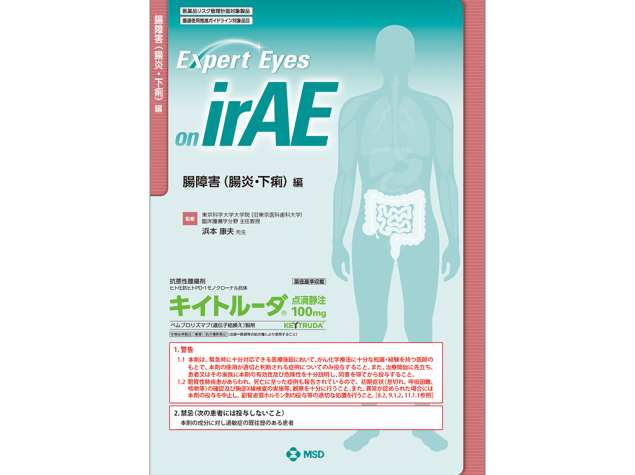 Expert Eyes on irAE：腸障害