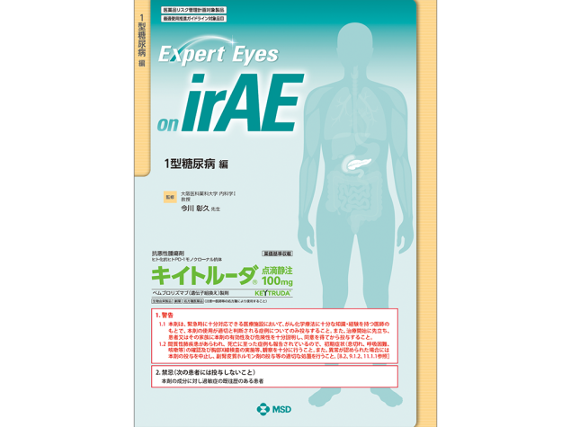 Expert Eyes on irAE：1型糖尿病