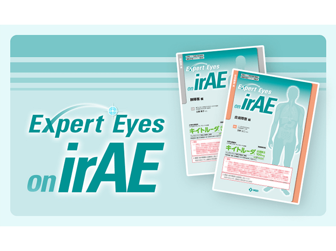 Expert Eyes on irAE