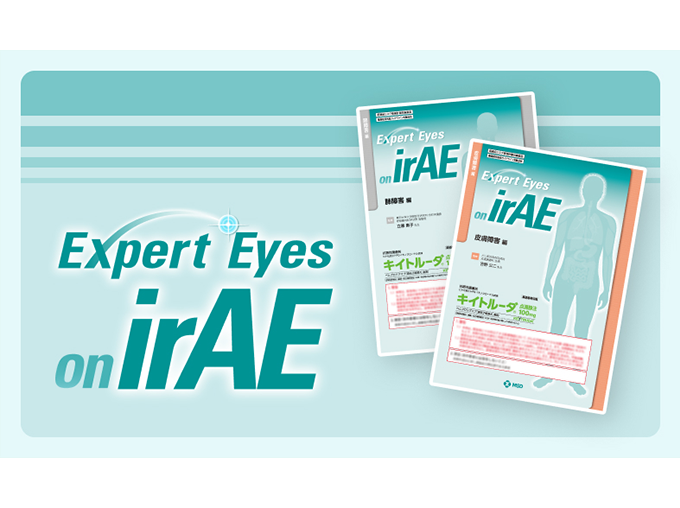 Expert Eyes on irAE