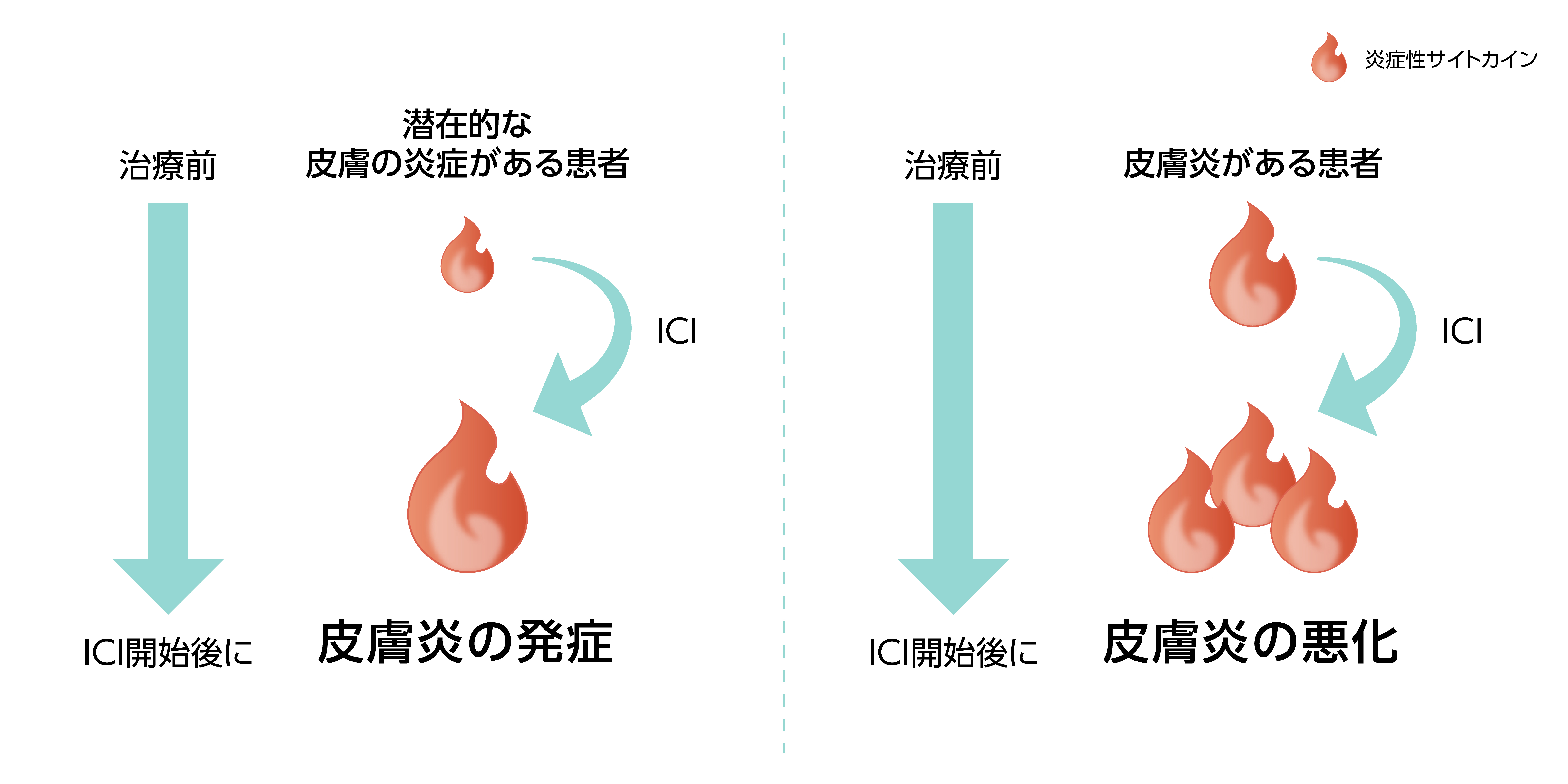 皮膚irAEの種類と発生メカニズム