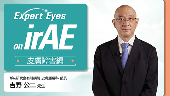 皮膚障害編 動画版