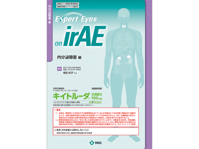 Expert Eyes on irAE：内分泌障害