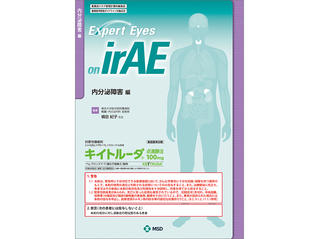 Expert Eyes on irAE：内分泌障害
