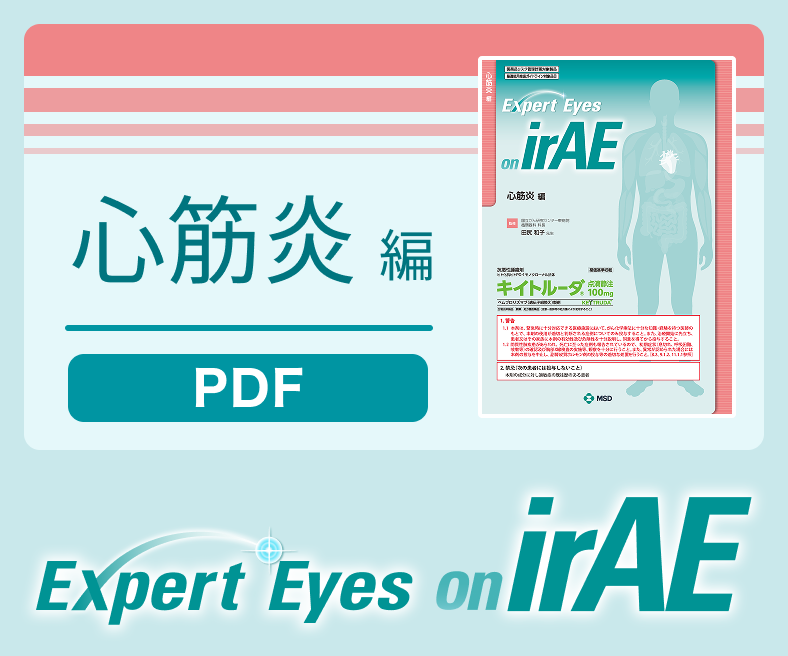 Expert Eyes on irAE 心筋炎編