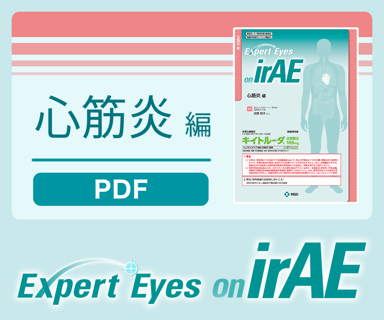 Expert Eyes on irAE 心筋炎編