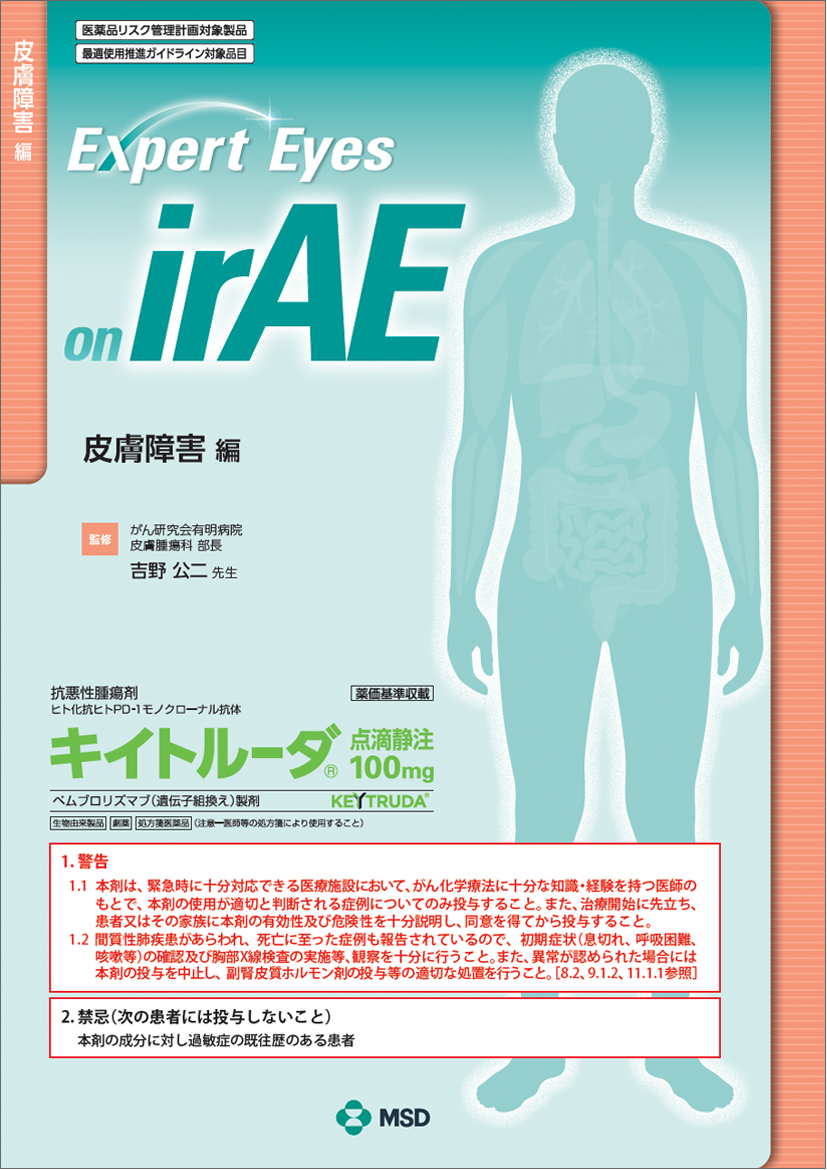 Expert Eyes on irAE