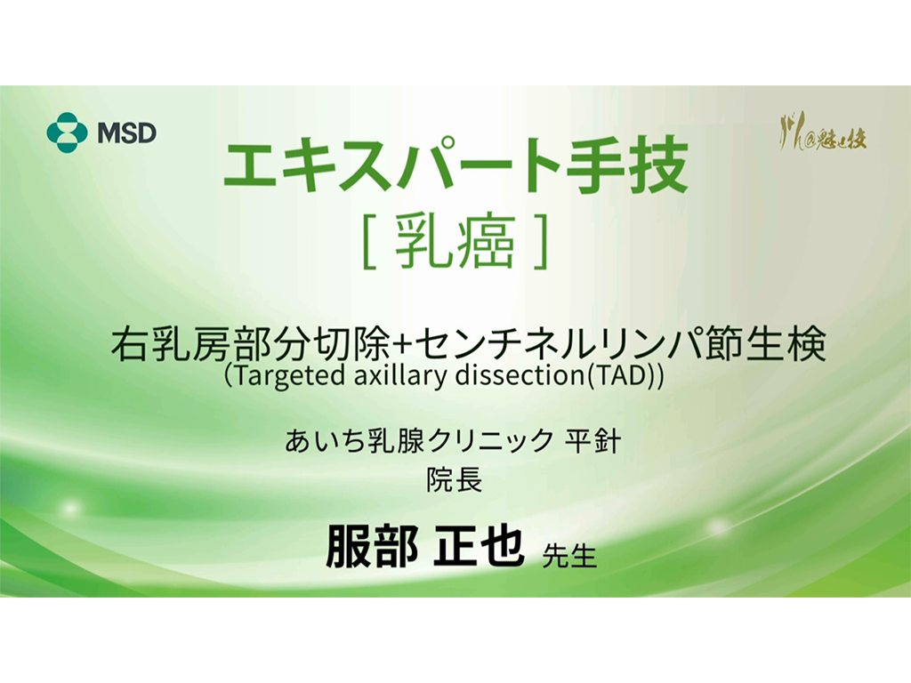【乳癌】エキスパート手技 右乳房部分切除+センチネルリンパ節生検（Targeted axillary dissection (TAD)）