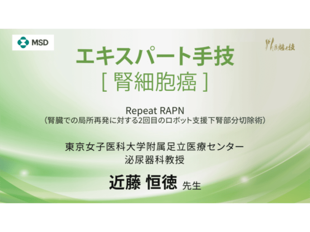 【腎細胞癌】エキスパート手技 Repeat RAPN（腎臓での局所再発に対する2回目のロボット支援下腎部分切除術）