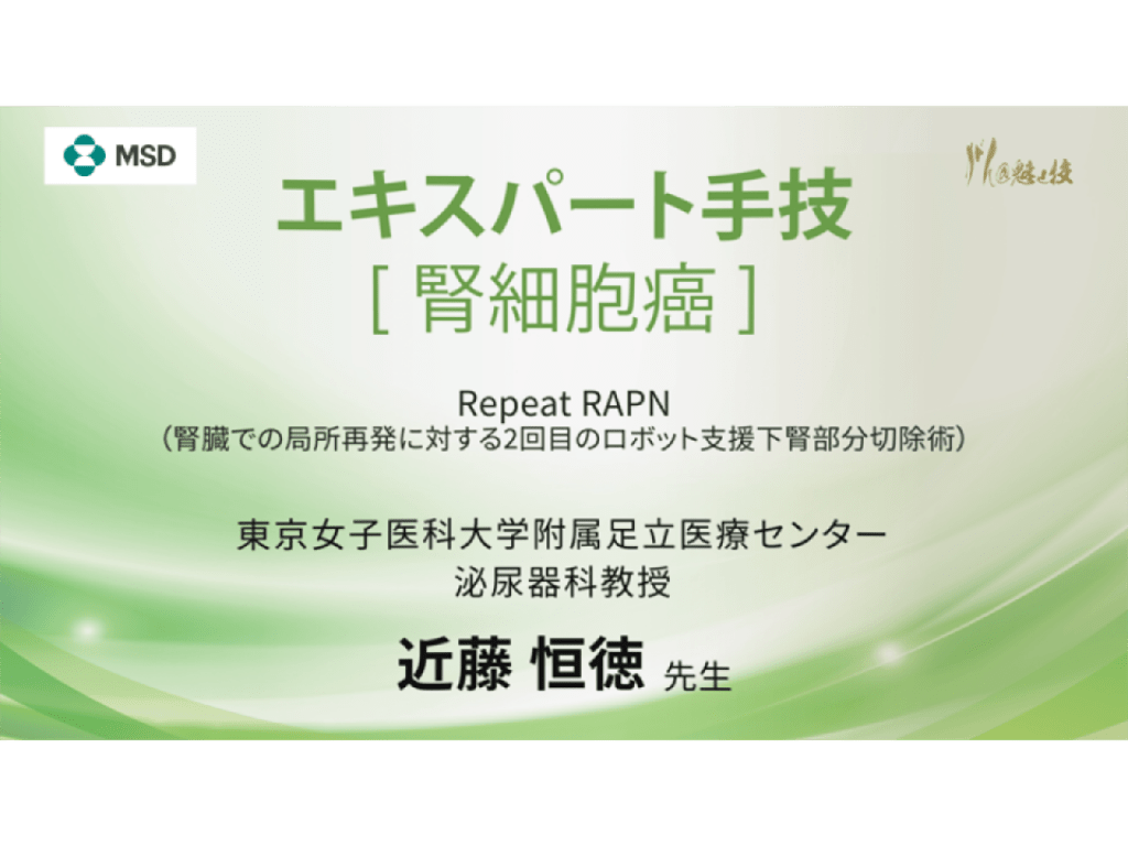 【腎細胞癌】エキスパート手技 Repeat RAPN（腎臓での局所再発に対する2回目のロボット支援下腎部分切除術）
