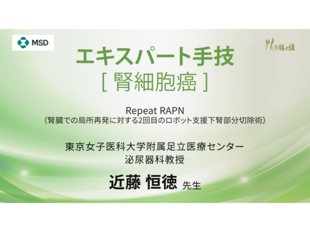 【腎細胞癌】エキスパート手技 Repeat RAPN（腎臓での局所再発に対する2回目のロボット支援下腎部分切除術）