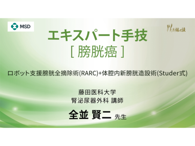 【尿路上⽪癌】エキスパート手技 ロボット⽀援膀胱全摘除術(RARC)+体腔内新膀胱造設術(Studer式)