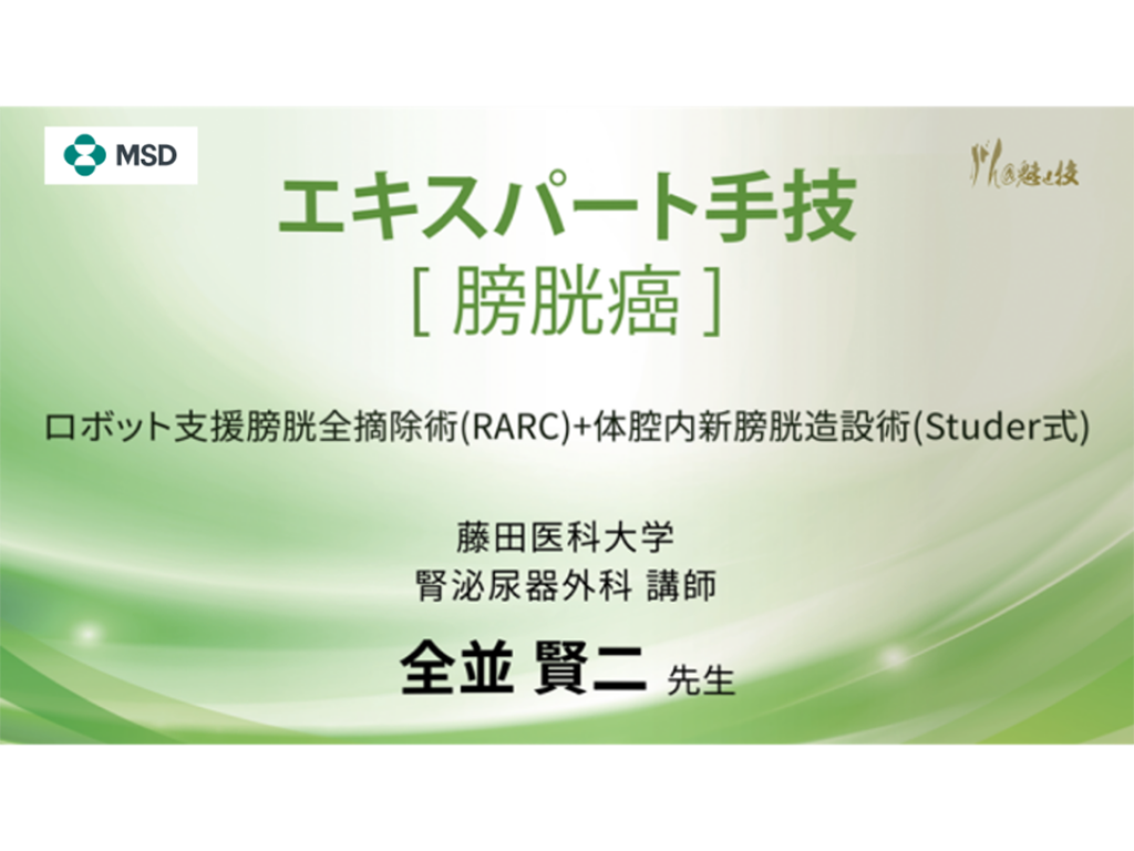 【尿路上⽪癌】エキスパート手技 ロボット⽀援膀胱全摘除術(RARC)+体腔内新膀胱造設術(Studer式)