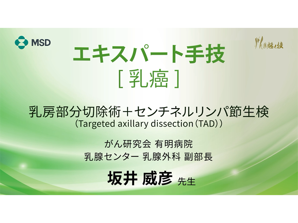 【乳癌】エキスパート手技 乳房部分切除術＋センチネルリンパ節⽣検（Targeted axillary dissection (TAD))