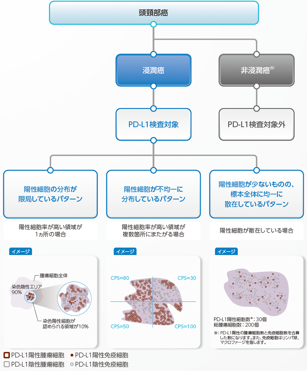 頭頸部癌におけるPD-L1検査(CPS)のアルゴリズム