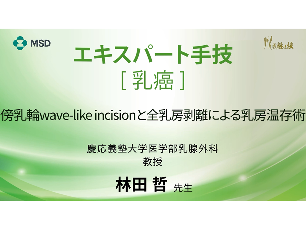 【乳癌】エキスパート手技 傍乳輪wave-like incisionと全乳房剥離による乳房温存術