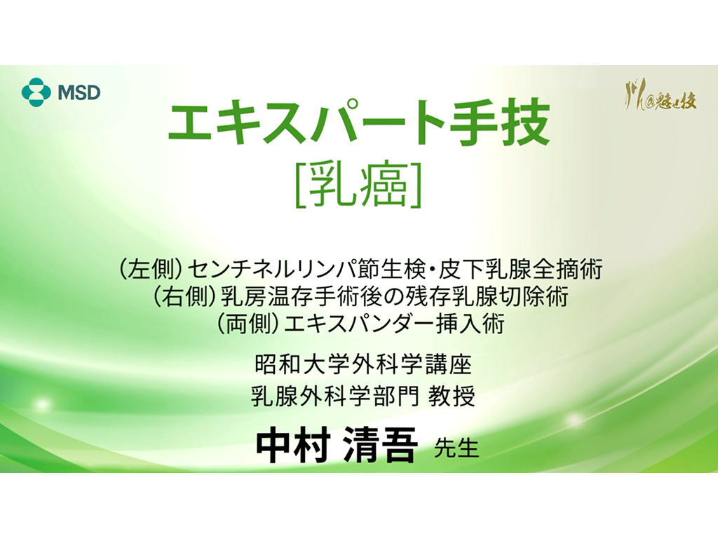 【乳癌】エキスパート手技 （左側）センチネルリンパ節生検・皮下乳腺全摘術 （右側）乳房温存手術後の残存乳腺切除術 （両側）エキスパンダー挿入術