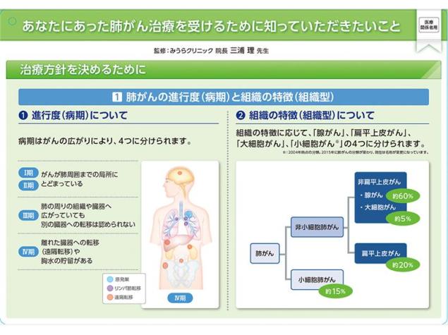 キイトルーダ® インフォームドコンセント用資料　患者説明用下敷き：＜非小細胞肺癌＞進行・再発