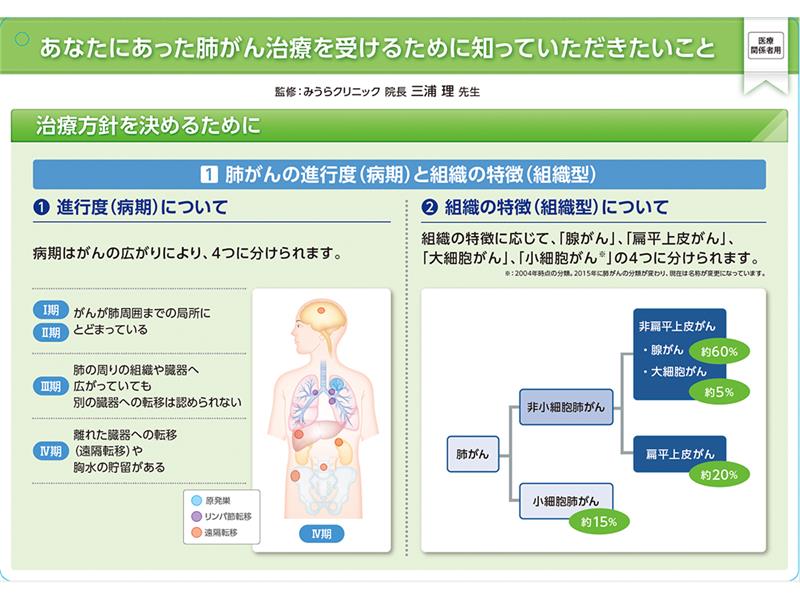 キイトルーダ® インフォームドコンセント用資料　患者説明用下敷き：＜非小細胞肺癌＞進行・再発