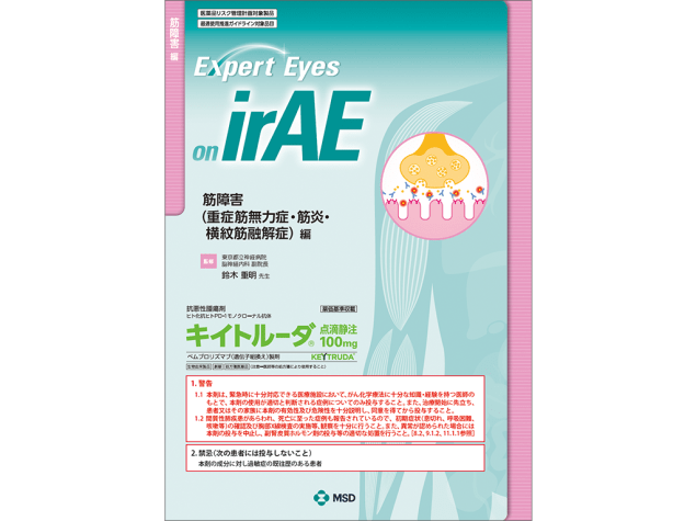 Expert Eyes on irAE：筋障害