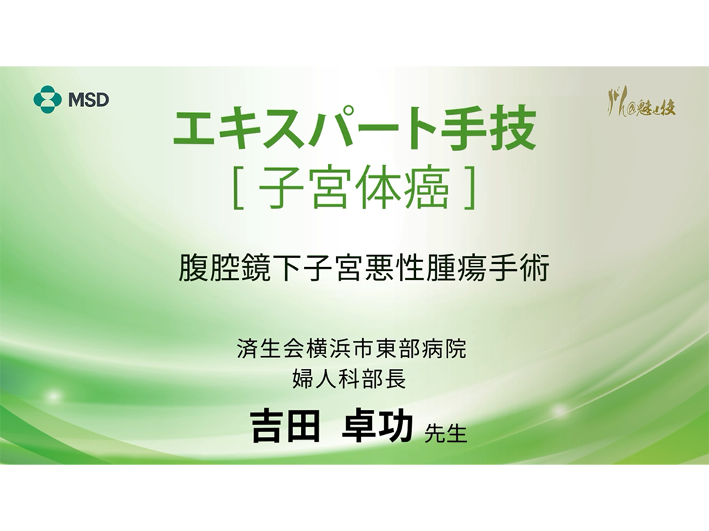 【子宮体癌】エキスパート手技 腹腔鏡下子宮悪性腫瘍手術