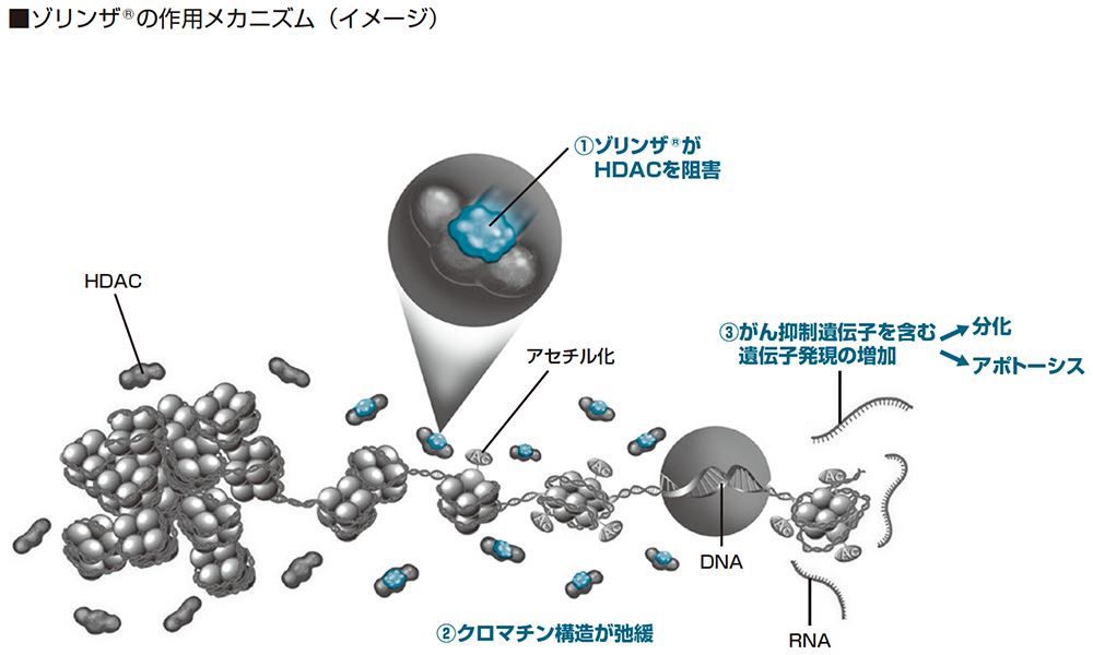 ゾリンザ®の作用メカニズム（イメージ）