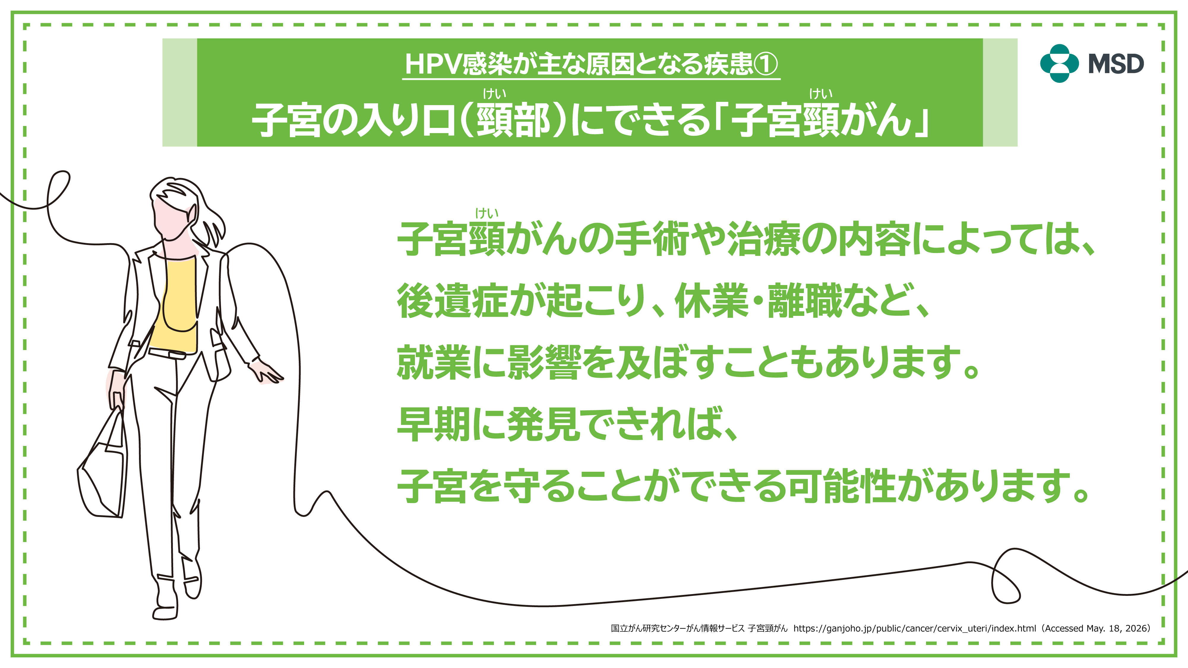 HPV感染が主な原因となる疾患①　子宮の入り口（頸部）にできる「子宮頸がん」2