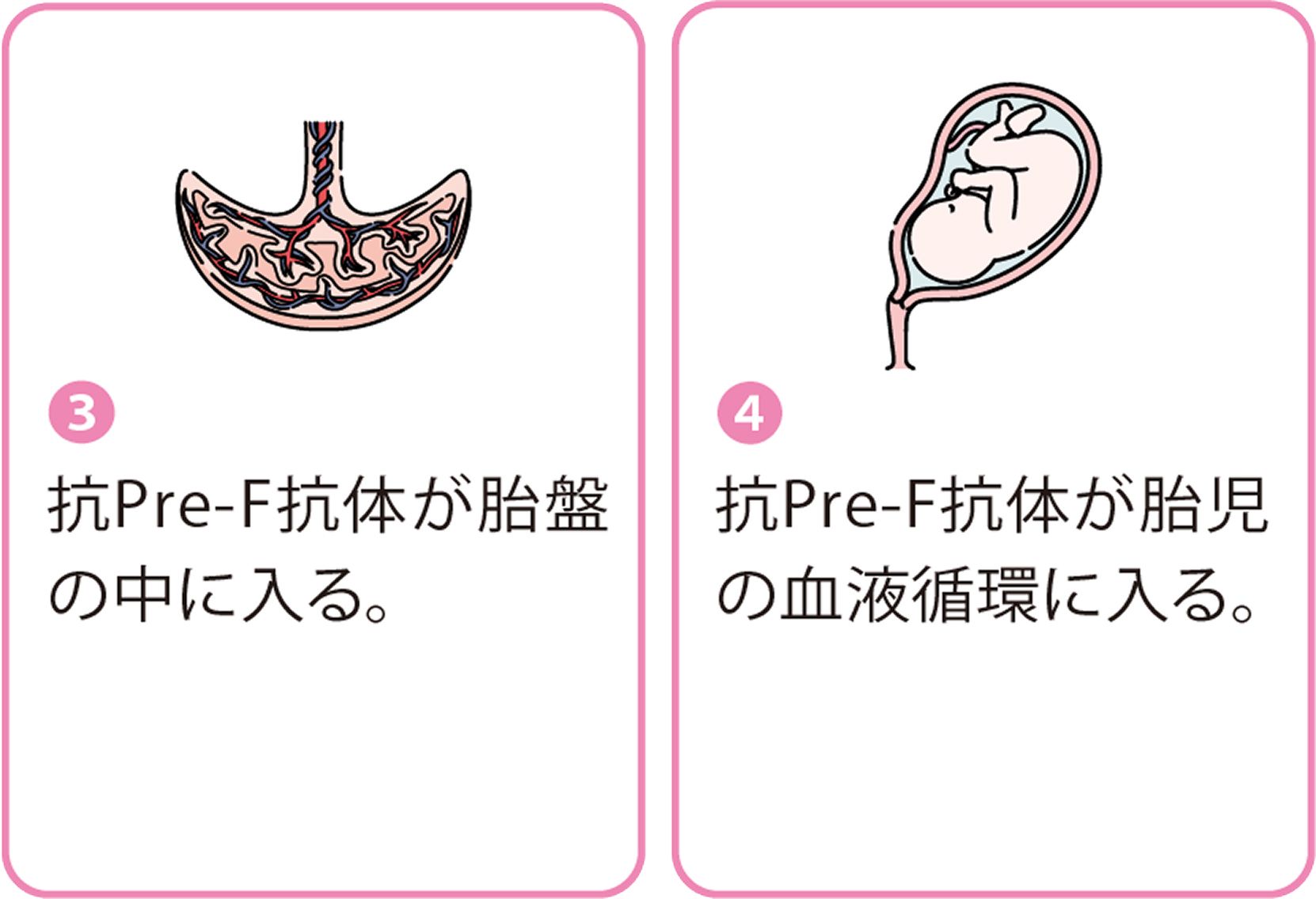 3.抗Pre-F抗体が胎盤の中に入る。 4.抗Pre-F抗体が胎児の血液循環に入る。