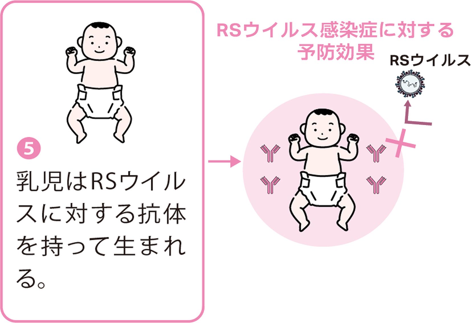 5.乳児はRSウイルスに対する抗体を持って生まれる。