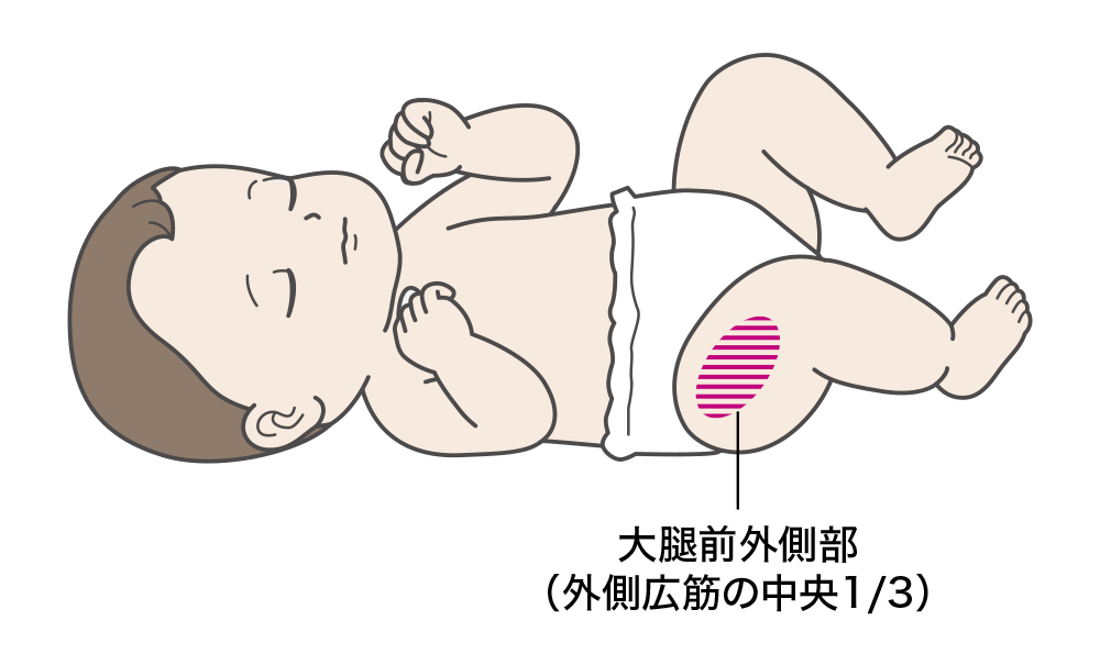 注射部位