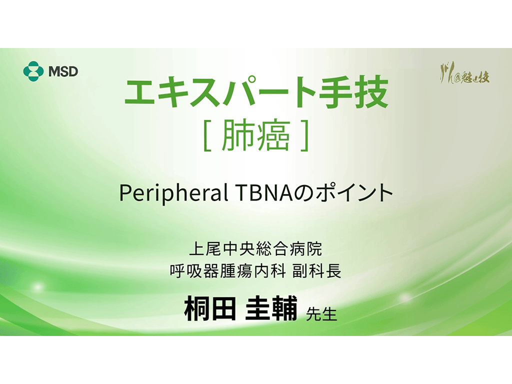 【肺癌】エキスパート手技 Peripheral TBNAのポイント