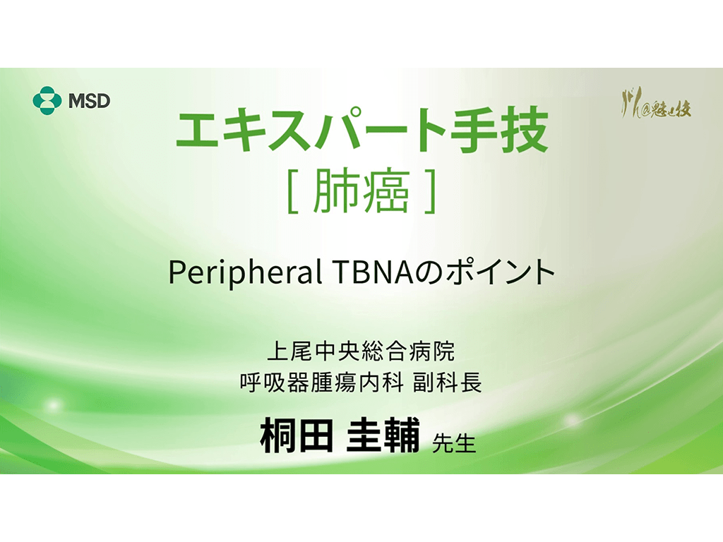 【肺癌】エキスパート手技 Peripheral TBNAのポイント