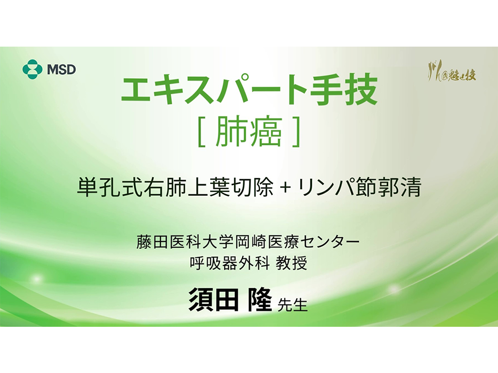 【肺癌】エキスパート手技 単孔式右肺上葉切除 + リンパ節郭清
