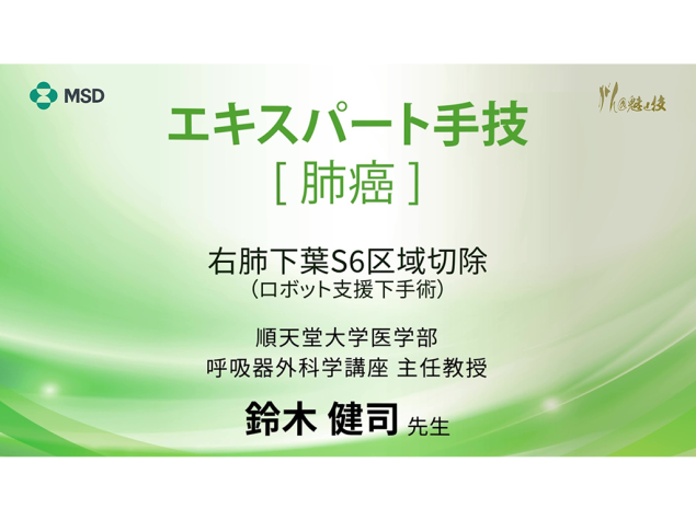 【肺癌】エキスパート手技 右肺下葉S6区域切除（ロボット⽀援下手術）
