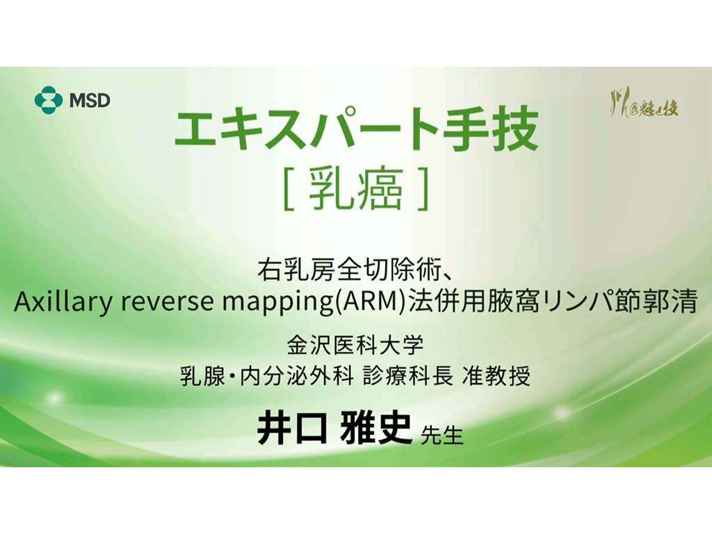 【乳癌】エキスパート手技 右乳房全切除術、Axillary reverse mapping（ARM）法併⽤腋窩リンパ節郭清