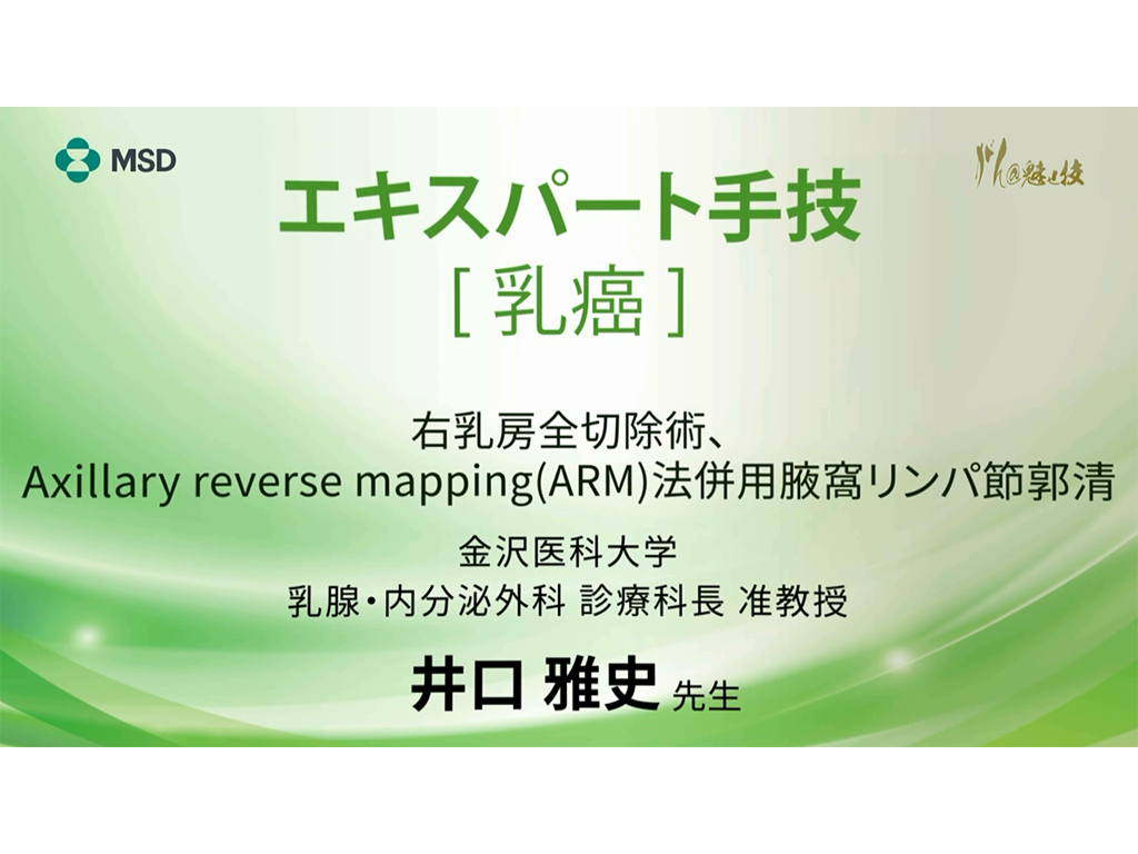 【乳癌】エキスパート手技 右乳房全切除術、Axillary reverse mapping（ARM）法併⽤腋窩リンパ節郭清