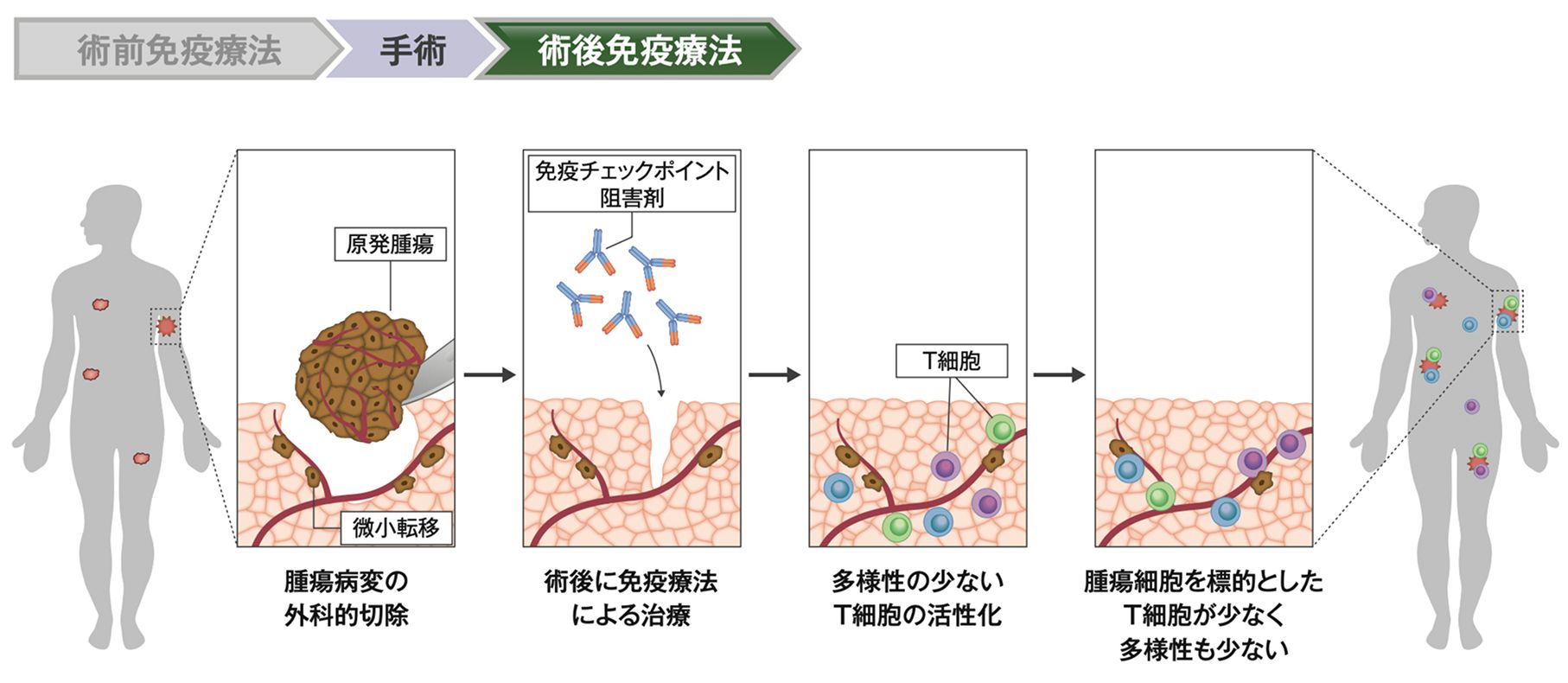 術後から免疫療法を行なった場合のT細胞の活性化