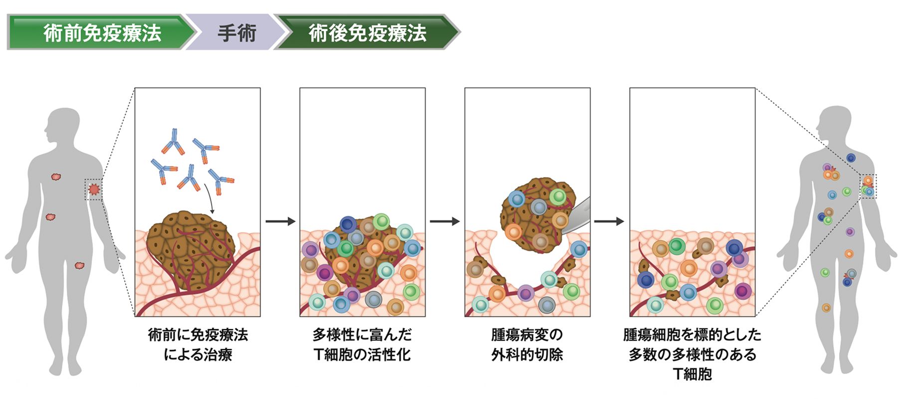 術前から免疫療法を行なった場合のT細胞の活性化