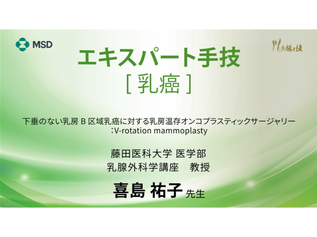【乳癌】エキスパート手技 下垂のない乳房B区域乳癌に対する乳房温存オンコプラスティックサージャリー：V-rotation mammoplasty