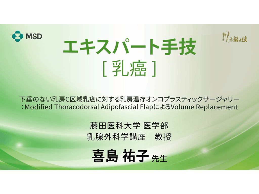 【乳癌】エキスパート手技 下垂のない乳房C区域乳癌に対する乳房温存オンコプラスティックサージャリー：Modified Thoracodorsal Adipofascial FlapによるVolume Replacement