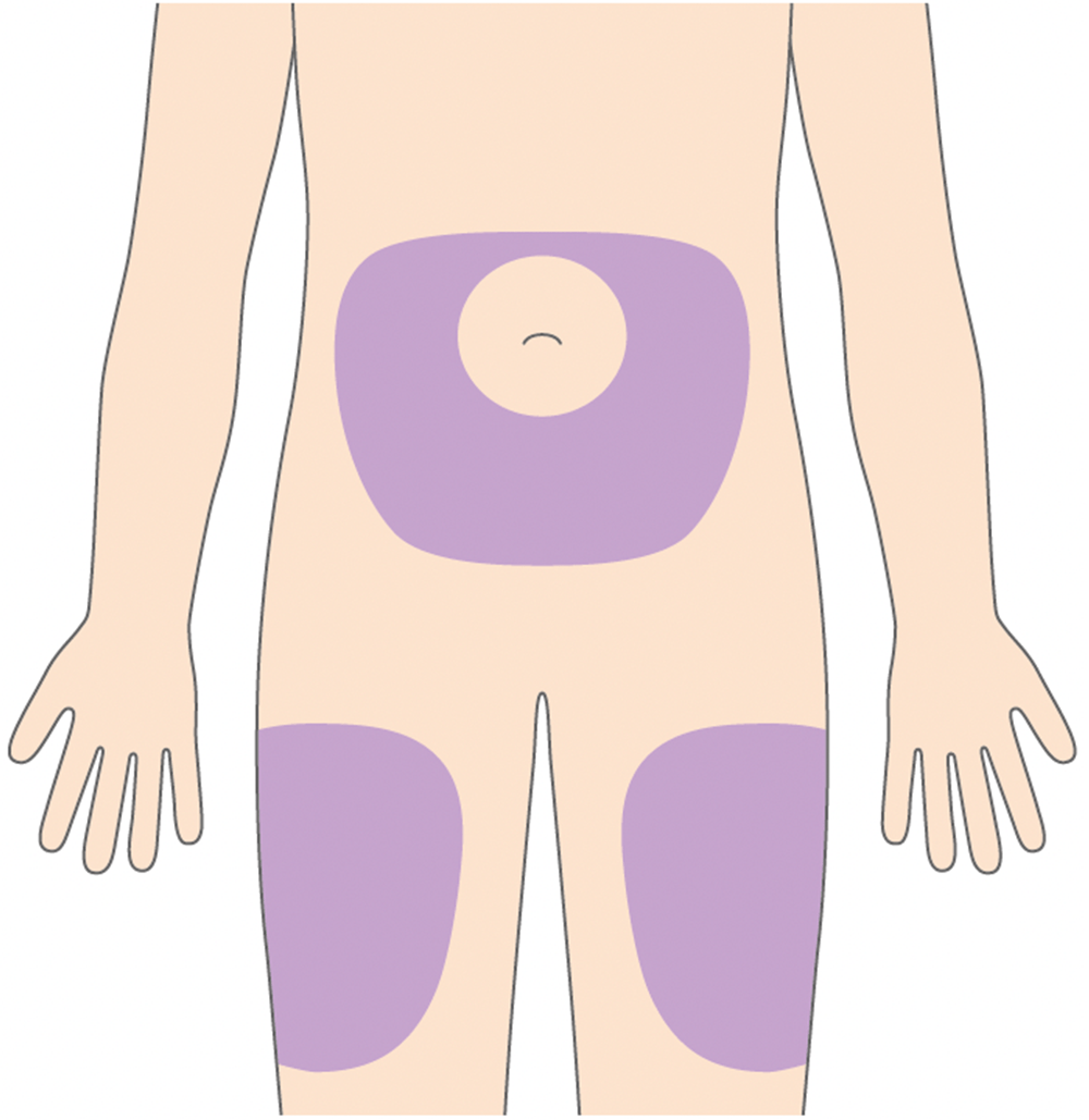 投与時の注意点